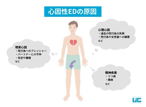 緊張で勃たない|心因性EDになったらどうすればいい？原因や治し方。